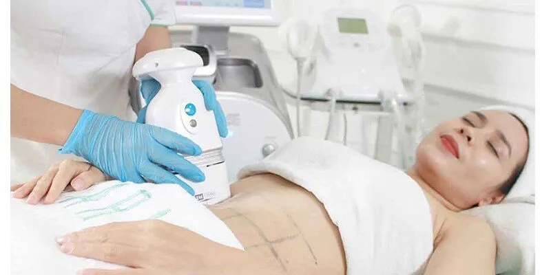 Công nghệ giảm mỡ mới nhất là gì?