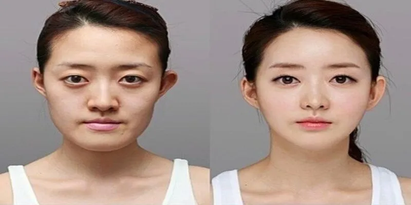 Nha khoa thẩm mỹ là nhóm dịch vụ cải thiện nụ cười