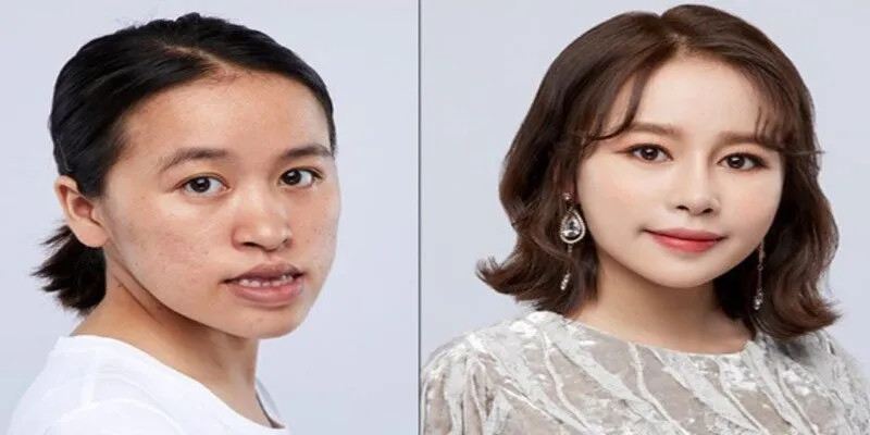 Ưu điểm của ngành thẩm mỹ