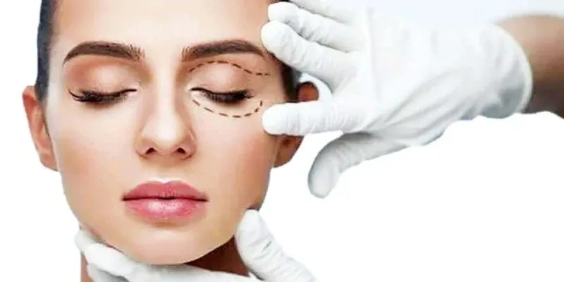 Yếu tố ảnh hưởng thời gian nghỉ dưỡng sau phẫu thuật thẩm mỹ